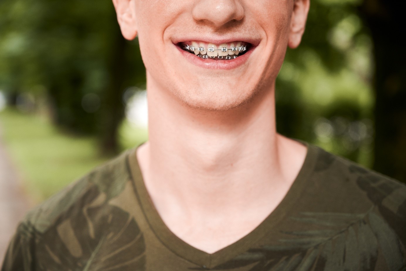 Felnőtt fogszabályozás